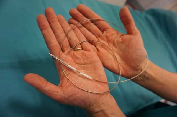 Elettrocatetere transvenoso da defibrillazione piu sottile di un anello nuziale - La Voce delle Valli